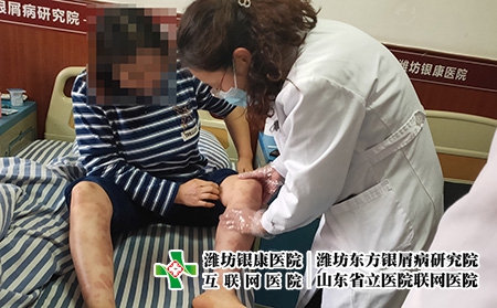 濰坊治療皮膚病院是哪家-濰坊治皮膚病到哪個專業(yè)